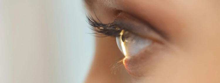 What Is Keratoconus?