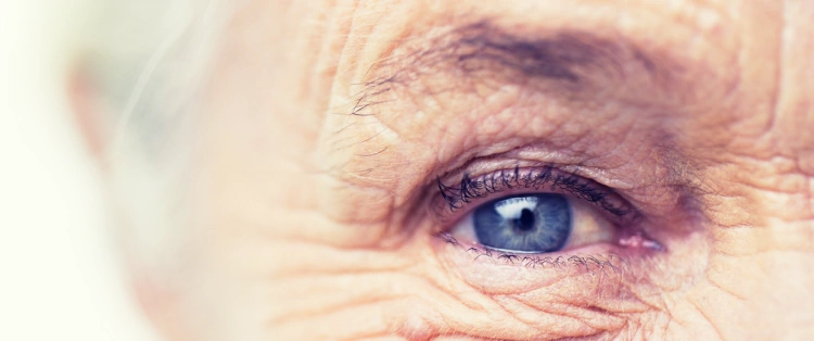 What is Macular Degeneration?